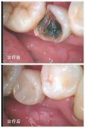 临沧昆大口腔地址在临翔
