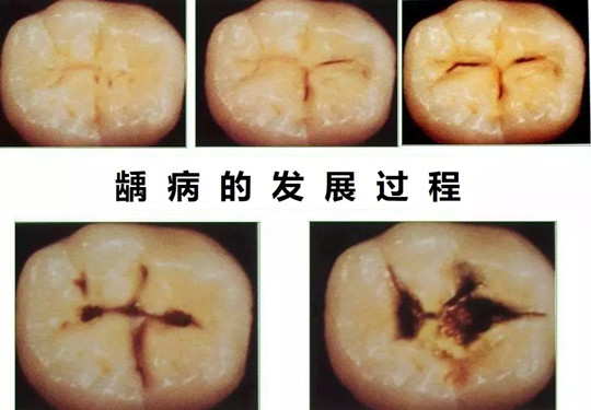 上海易美口腔种牙矫正收费高吗？不高、种植牙2880起、矫正8800起