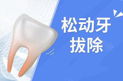 全瓷烤瓷牙能用多久会脱落吗?北京圣贝口腔专业解析使用寿命与维护要点