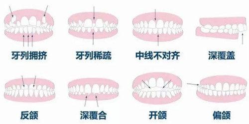 青岛牙齿美白医院名单！TOP5医院名单一览，速来围观