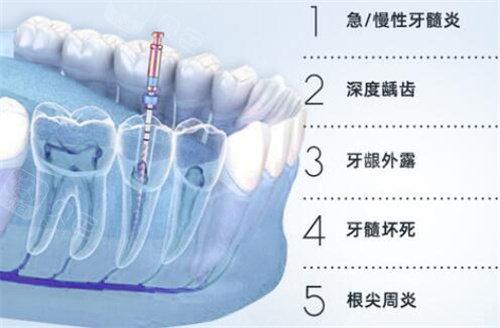 成都极光口腔是否正规?收费标准怎么样?游学敏正畸价格一览