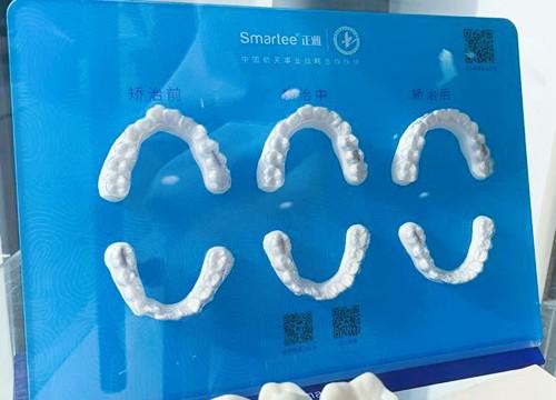 阜阳地区口腔医院排名前