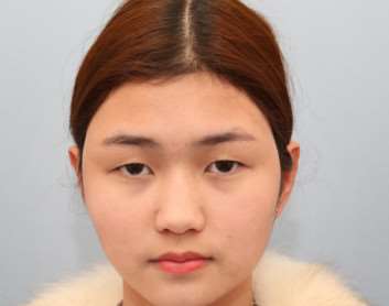 威海华怡美容整形私密整形收费价格表，阴蒂体切除：275\阴蒂缩小：1744起