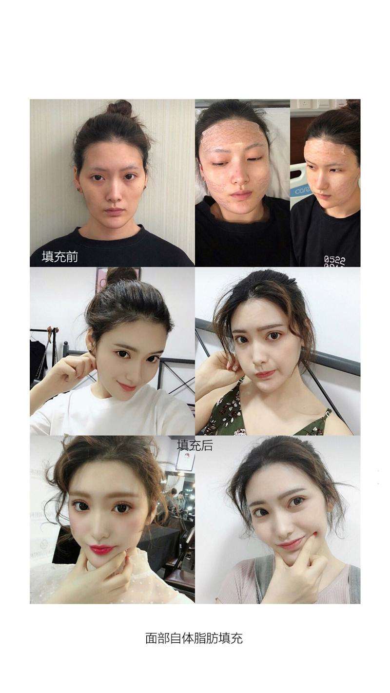 大理韩美医疗美容眼部整形收费价格表，眼角修复手术：1561\眼睑矫正：27起