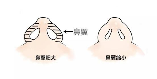 广州熙施时光医疗美容怎么样？鼻部整形技术怎么样？点开了解详情
