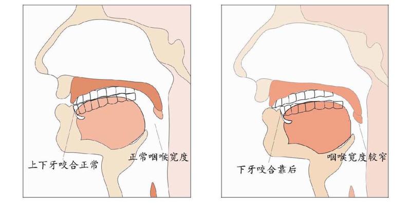 北京画美医疗美容医院鼻部整形怎么样?真实案例与专业解读