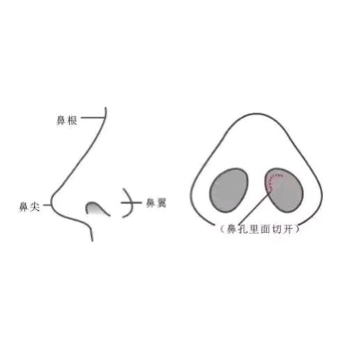 安徽医科大学第一附属医院整形外科鼻部整形好吗?医生水平效果-真实案例参考