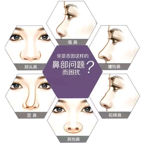 北京画美医疗美容医院鼻部整形怎么样?真实案例与专业解读