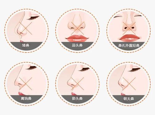 南昌臻爱医疗美容门诊部怎么样?口碑良好,技术实力强