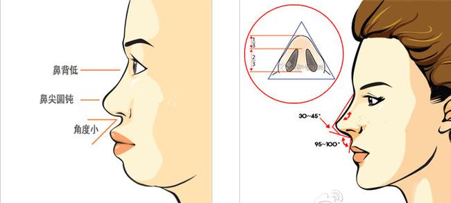 深圳鼻部整形哪家医院好？专业团队、技术特色与口碑全解析