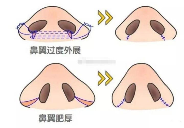 成都市武侯区璞龄医疗美容门诊部隆鼻怎么样?口碑医生分享、有哪些项目