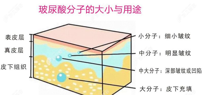南京美莱医疗美容门诊部玻尿酸注射医生有哪些?玻尿酸注射技术口碑点评、经典案例品鉴