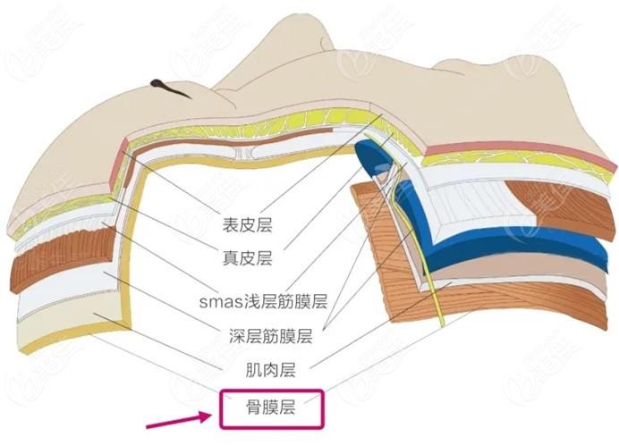 玻尿酸祛泪沟优缺点解析