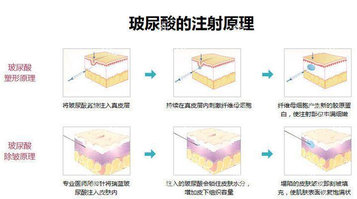 南京康美美容医院整形美容科怎么样?内附医院信息+案例分享