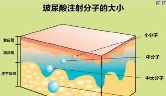 贵阳利美康外科医院(总院)医疗美容科抗衰除皱技术怎么样?专家坐诊+抗衰术后点评