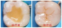 惠州七大牙科医院收费明