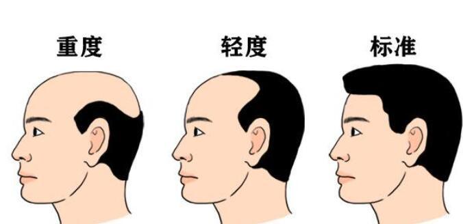 重庆当代整形外科医院植发中心医生有哪些?植发专业医生简介奉上!