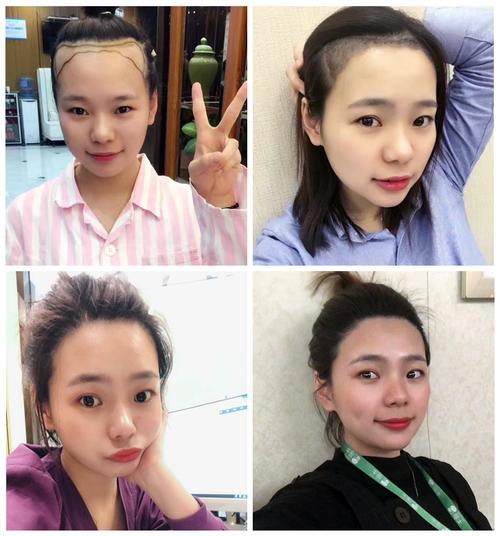 重庆当代整形外科医院植发中心医生有哪些?植发专业医生简介奉上!