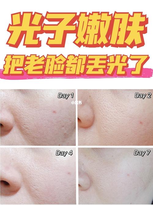 长沙美亚口腔双眼皮修复技术怎么样？三位求美者真实经历揭晓专业医疗实力！