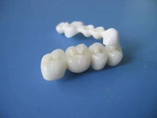 北京优贝口腔做全瓷烤瓷牙怎么样?专业医生团队搭配透明收费获患者承认!