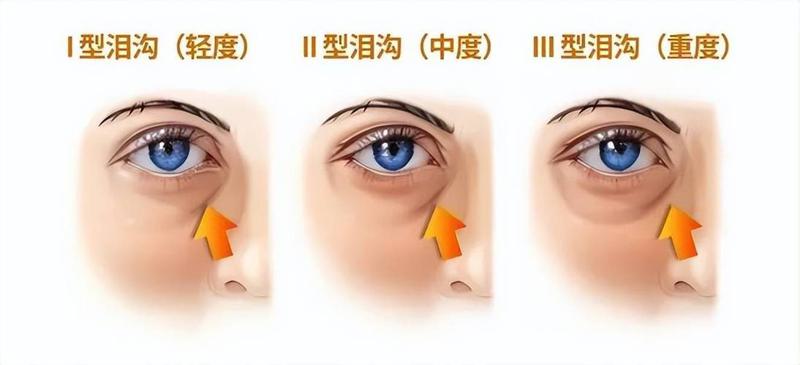 长沙天心王清波口腔下睑下至价格表（较低9093元丨38532元丨均价23812元）