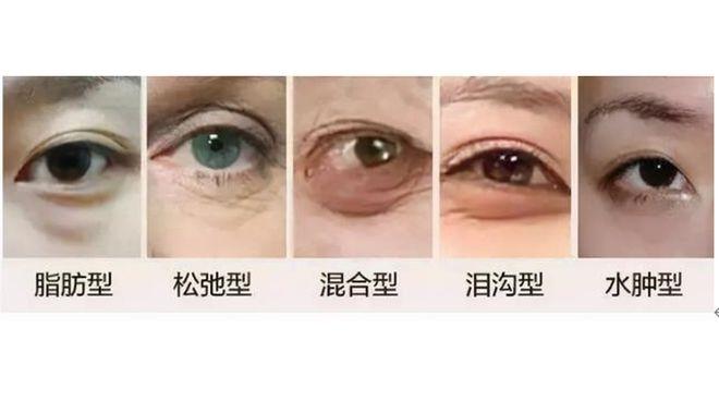 沈阳曙光整形外科医院,专业医美机构推荐