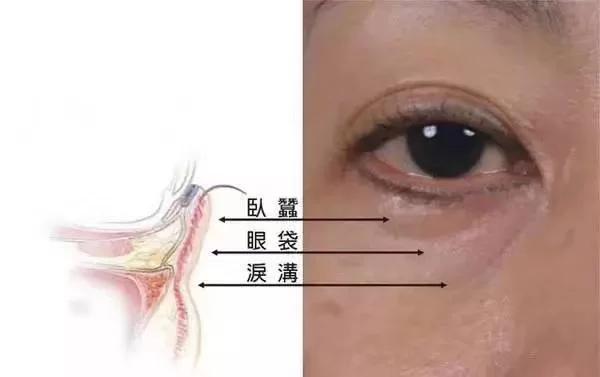 在重庆多家机构仔细对比后较终选择李红萍口腔进行玻尿酸祛泪沟