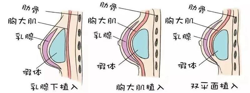 哈尔滨市肖啸医生怎么样？隆胸与鼻部整形专家，为您塑造好身形