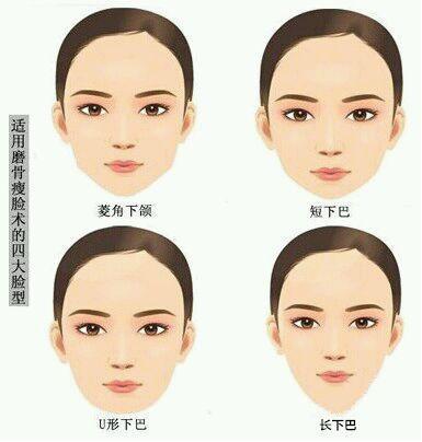 带牙套影响做下颌角手术