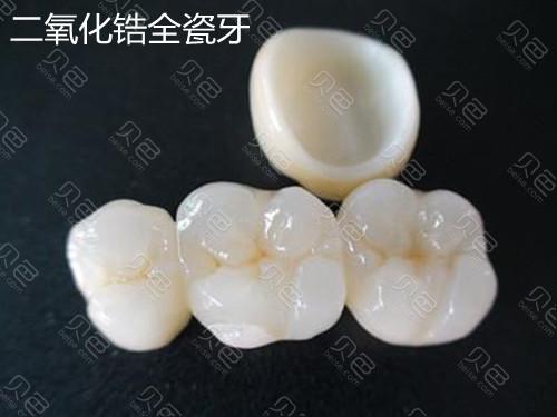 2025金华贝佳口腔·矫正种植中心收费标准:种植牙3200+矫正牙齿11800+补牙280+