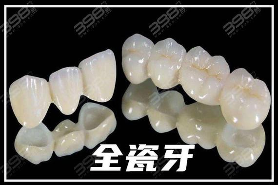 二氧化锆全瓷牙和爱尔创哪个好?二氧化锆强度更高,爱尔创性价比更优