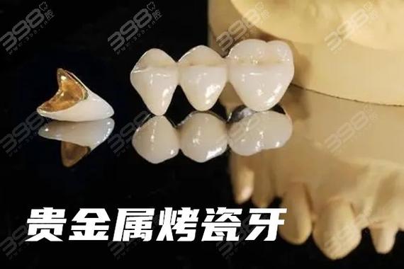 2025年1200元一颗全瓷牙值