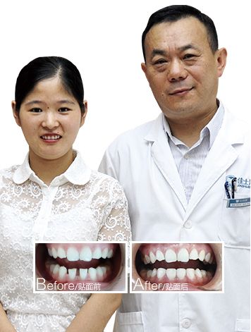成都美雅口腔(都江堰店)价格表公布:种牙6500丨矫正牙齿8500
