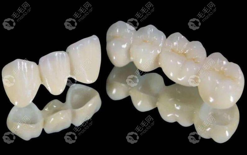 口腔革新力量!绵阳欧飞口腔牙齿种植成功案例全解析+专业咨询通道,市民口碑爆棚!