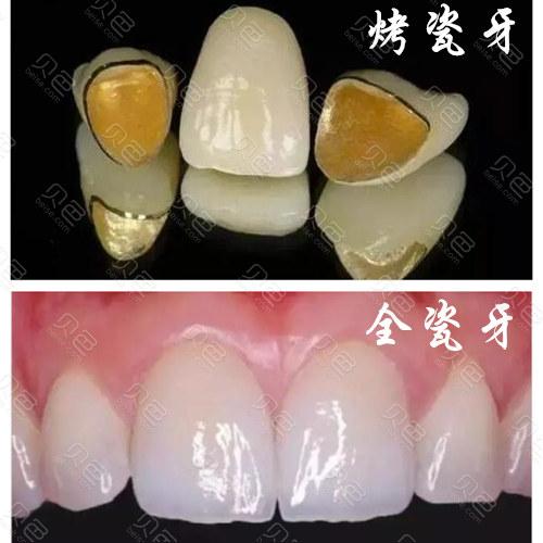 濮阳雅美口腔(中原路店)•种植矫正中心价格表2025含牙齿矫正丨种植牙丨镶牙丨拔牙收费标准