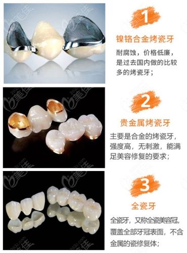 福州华成口腔种牙价格是多少?单颗8500元起丨半口5万丨全口10万元起
