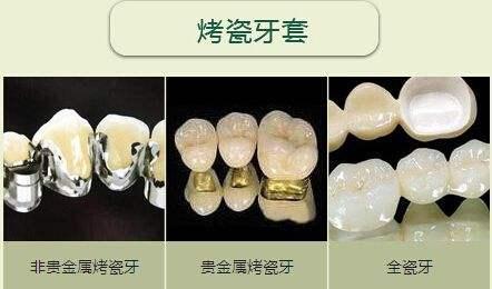 上海贝德口腔牙齿矫正技术怎么样？医师经验足方案定制更安心