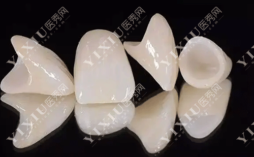 北京优贝口腔全瓷烤瓷牙价格表(国产2800元起丨进口4500元起丨附医生团队介绍)
