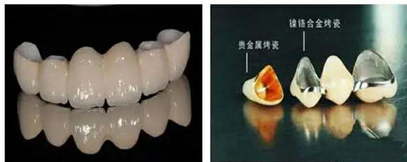 厦门齿度口腔·牙齿美学美白(思北店)评价怎么样?从真实案例看这家专业牙科的技术实力与服务品质