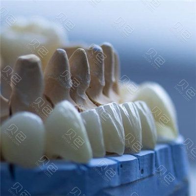 泽康全瓷牙3000贵吗？听说有泽康2000、3500、3800元起是真的吗？