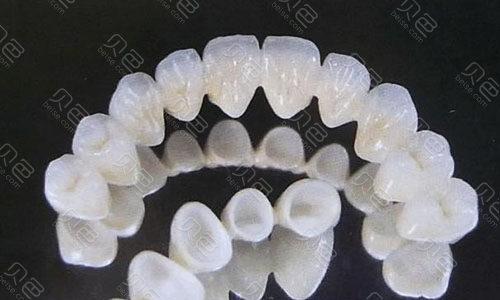 泽康和威兰德哪个适合做门牙？通透度、价格、材质、寿命对比