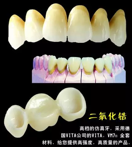 牙齿种植的优缺点是什么?珠海摩尔口腔专家解析种植体材质与术后养护指南