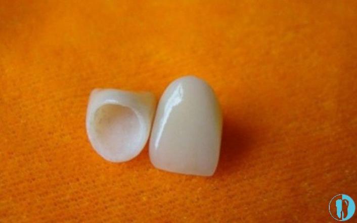 北京圣贝口腔贵金属烤瓷牙价格表及医生团队介绍