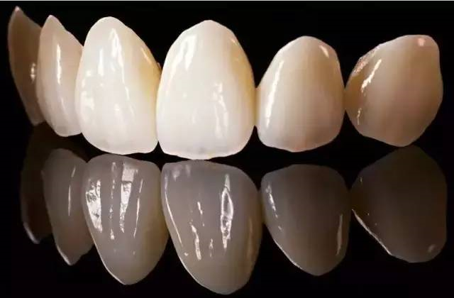 二氧化锆全瓷牙和烤瓷牙有什么区别?九江华博口腔专家详解5大核心差异!