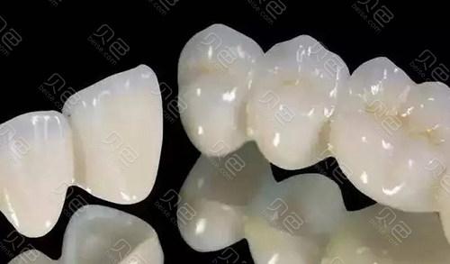 做全瓷牙上下16颗后悔的多吗？我做16颗全瓷牙5万还不如种牙