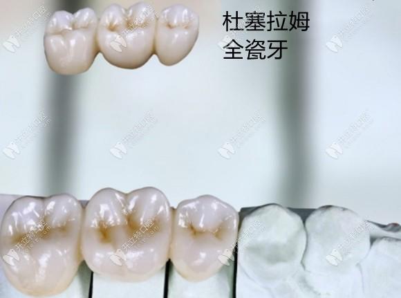 晋中海峰口腔牙齿种植价格表公布,种植牙收费标准详解