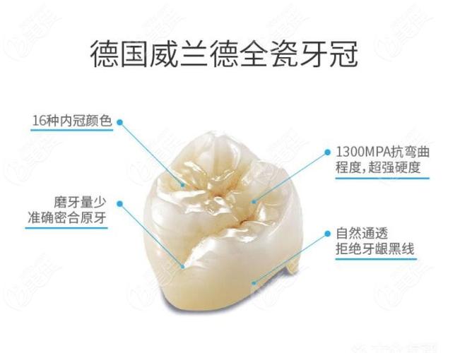全瓷牙贴面牙不齐可以做