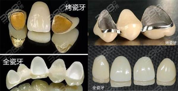 2025宜昌和谐口腔医院收费标准:种植牙3200+矫正牙齿11800+补牙280+