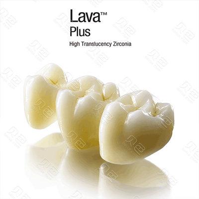 北京劲松口腔医院种植牙是什么材质的？能用多久？有什么优缺点？