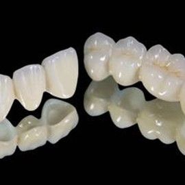 秦皇岛致美口腔医院牙齿种植好不好？医生专业、技术先进，种植牙患者满意度高反馈优异
